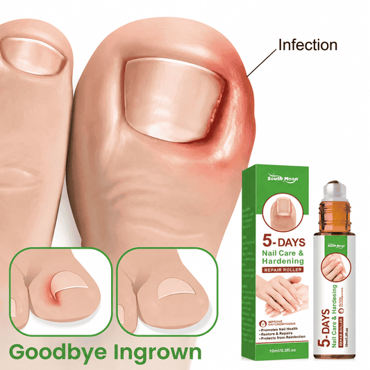 Nail Repair for Damaged Nails